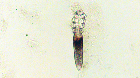 Demodex, Демодекс, профилактика и лечение, НДЦ Ретиноиды